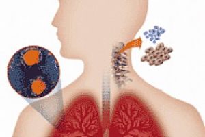 Exame espirometria